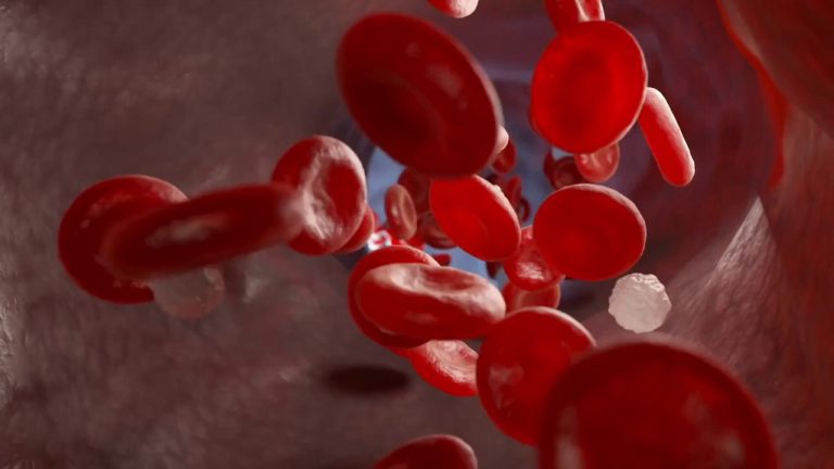 Beta-Talassemia, nuova molecola riduce la necessità di sangue